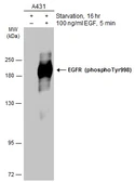 Anti-EGFR (phospho Tyr998) antibody used in Western Blot (WB). GTX133427