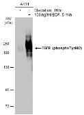 Anti-EGFR (phospho Tyr992) antibody used in Western Blot (WB). GTX133429