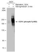 Anti-EGFR (phospho Tyr992) antibody used in Western Blot (WB). GTX133429