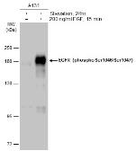 Anti-EGFR (phospho Ser1046/Ser1047) antibody used in Western Blot (WB). GTX133433