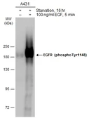 Anti-EGFR (phospho Tyr1148) antibody used in Western Blot (WB). GTX133435