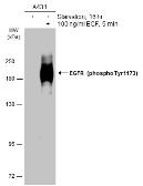 Anti-EGFR (phospho Tyr1173) antibody used in Western Blot (WB). GTX133437