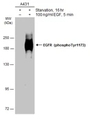 Anti-EGFR (phospho Tyr1173) antibody used in Western Blot (WB). GTX133437