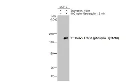 Anti-Her2 / ErbB2 (phospho Tyr1248) antibody used in Western Blot (WB). GTX133439