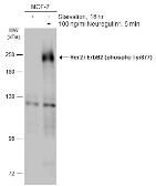 Anti-Her2 / ErbB2 (phospho Tyr877) antibody used in Western Blot (WB). GTX133443
