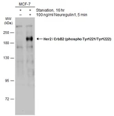 Anti-Her2 / ErbB2 (phospho Tyr1221/Tyr1222) antibody used in Western Blot (WB). GTX133445
