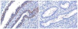 Anti-Her2 / ErbB2 (phospho Tyr1221/Tyr1222) antibody used in IHC (Paraffin sections) (IHC-P). GTX133445
