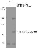 Anti-IGF1R (phospho Tyr1316) antibody used in Western Blot (WB). GTX133448
