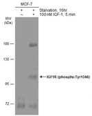 Anti-IGF1R beta (phospho Tyr1316) antibody used in Western Blot (WB). GTX133448