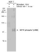 Anti-IGF1R (phospho Tyr950) antibody used in Western Blot (WB). GTX133449