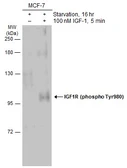 Anti-IGF1R beta (phospho Tyr950) antibody used in Western Blot (WB). GTX133449