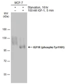 Anti-IGF1R (phospho Tyr1131) / Insulin Receptor (phospho Tyr1146) antibody used in Western Blot (WB). GTX133450