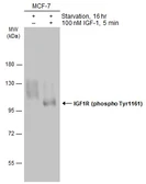 Anti-IGF1R beta (phospho Tyr1131) / Insulin Receptor beta (phospho Tyr1146) antibody used in Western Blot (WB). GTX133450