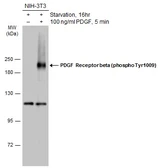 Anti-PDGF Receptor beta (phospho Tyr1009) antibody used in Western Blot (WB). GTX133453