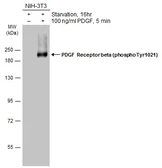 Anti-PDGF Receptor beta (phospho Tyr1021) antibody used in Western Blot (WB). GTX133454