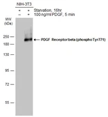 Anti-PDGF Receptor beta (phospho Tyr771) antibody used in Western Blot (WB). GTX133456