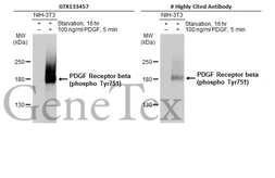 Anti-PDGF Receptor beta (phospho Tyr751) antibody used in Western Blot (WB). GTX133457