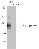 Anti-FGFR1 (phospho Tyr766) antibody used in Western Blot (WB). GTX133459