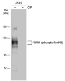 Anti-FGFR1 (phospho Tyr766) antibody used in Western Blot (WB). GTX133459