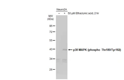 Anti-p38 MAPK (phospho Thr180/Tyr182) antibody used in Western Blot (WB). GTX133460