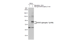 Anti-STAT3 (phospho Tyr705) antibody used in Western Blot (WB). GTX133464