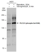 Anti-PLCG1 (phospho Ser1248) antibody used in Western Blot (WB). GTX133466