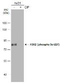 Anti-RSK2 (phospho Ser227) antibody used in Western Blot (WB). GTX133470