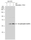 Anti-Src (phospho Tyr527) antibody used in Western Blot (WB). GTX133473