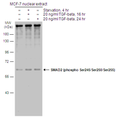 Anti-SMAD2 (phospho Ser245/Ser250/Ser255) antibody used in Western Blot (WB). GTX133475
