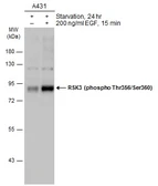 Anti-RSK3 (phospho Thr356/Ser360) antibody used in Western Blot (WB). GTX133480