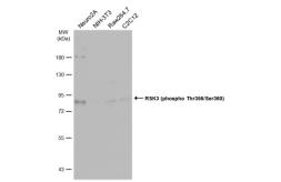 Anti-RSK3 (phospho Thr356/Ser360) antibody used in Western Blot (WB). GTX133480