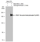 Anti-PDGF Receptor beta (phospho Tyr857) antibody used in Western Blot (WB). GTX133521