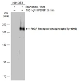 Anti-PDGF Receptor beta (phospho Tyr1009) antibody used in Western Blot (WB). GTX133522