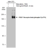 Anti-PDGF Receptor beta (phospho Tyr771) antibody used in Western Blot (WB). GTX133524
