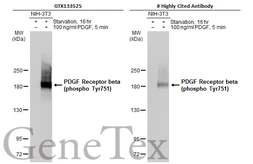Anti-PDGF Receptor beta (phospho Tyr751) antibody used in Western Blot (WB). GTX133525