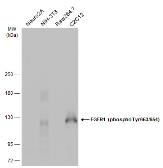 Anti-FGFR1 (phospho Tyr653/654) antibody used in Western Blot (WB). GTX133526