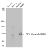 Anti-FGFR1 (phospho Tyr653/654) antibody used in Western Blot (WB). GTX133526