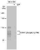 Anti-FGFR1 (phospho Tyr766) antibody used in Western Blot (WB). GTX133527