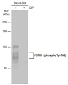 Anti-FGFR1 (phospho Tyr766) antibody used in Western Blot (WB). GTX133527