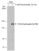 Anti-PLCG2 (phospho Tyr759) antibody used in Western Blot (WB). GTX133528