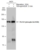 Anti-PLCG1 (phospho Ser1248) antibody used in Western Blot (WB). GTX133530