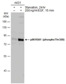 Anti-p90 RSK1 (phospho Thr359) antibody used in Western Blot (WB). GTX133531