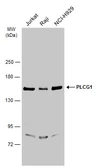 Anti-PLCG1 antibody used in Western Blot (WB). GTX133546
