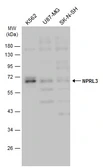 Anti-NPRL3 antibody used in Western Blot (WB). GTX133549