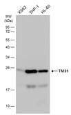 Anti-TMS1 antibody used in Western Blot (WB). GTX133561