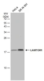 Anti-LAMTOR1 antibody used in Western Blot (WB). GTX133563