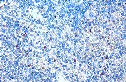 Anti-NLRP3 antibody used in IHC (Paraffin sections) (IHC-P). GTX133569