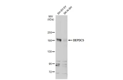 Anti-DEPDC5 antibody used in Western Blot (WB). GTX133570