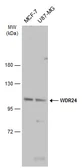 Anti-WDR24 antibody used in Western Blot (WB). GTX133576