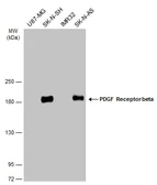 Anti-PDGF Receptor beta antibody used in Western Blot (WB). GTX133587